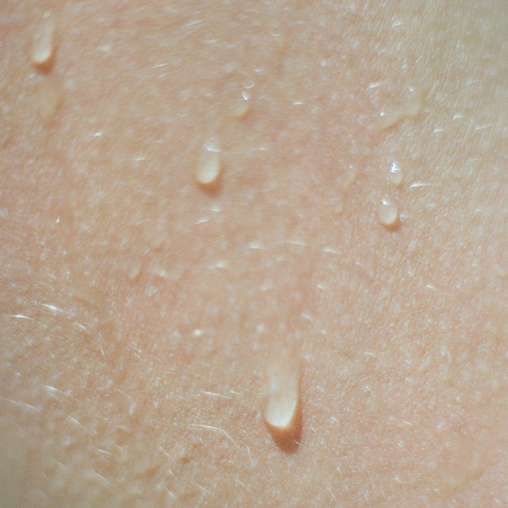 Close-up of skin with visible water droplets illustrating dehydration signs.